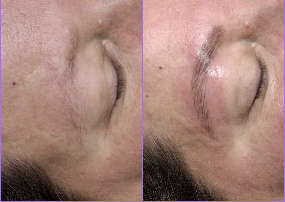 Brow Lamination