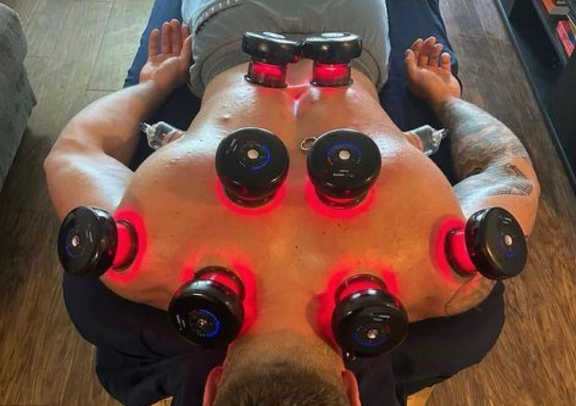 CUPPING MASSAGE 
