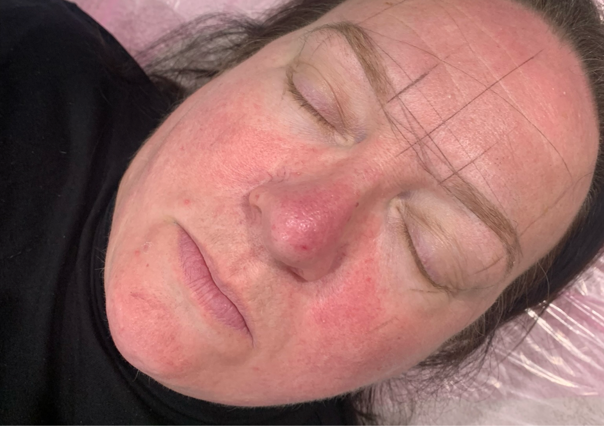 Free Consultation for PMU & patch test (mapping optional)