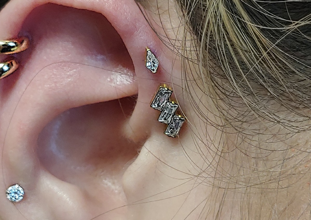 Forward Helix