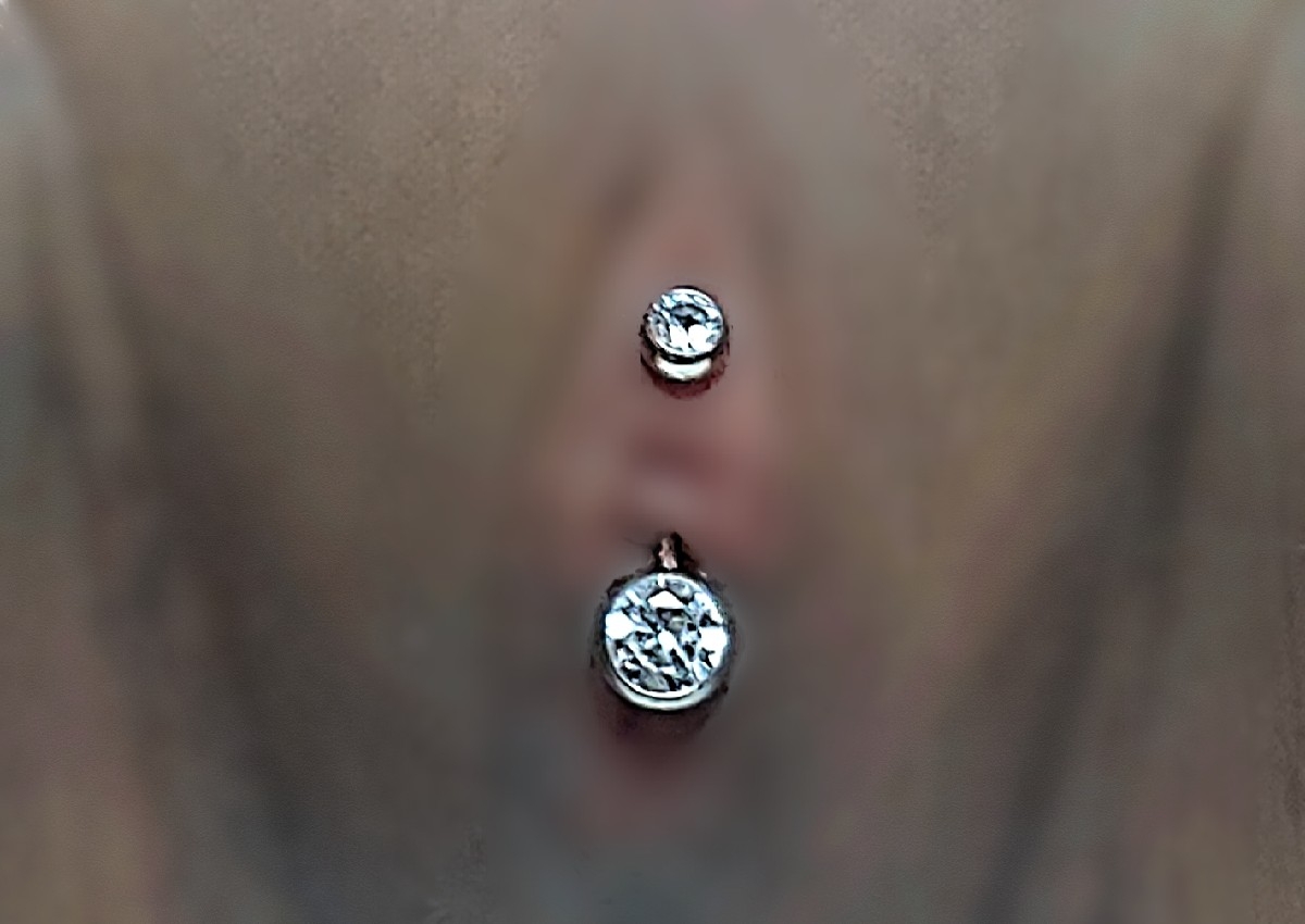 VCH/Vertical Clitoral Hood