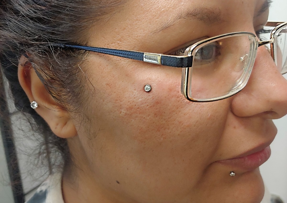 Dermal (Must be 18+)