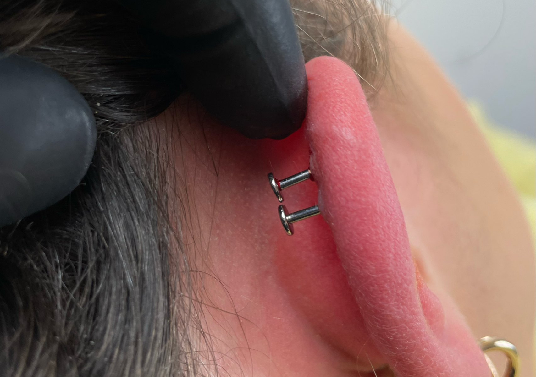 Changement de tige (downsizing)