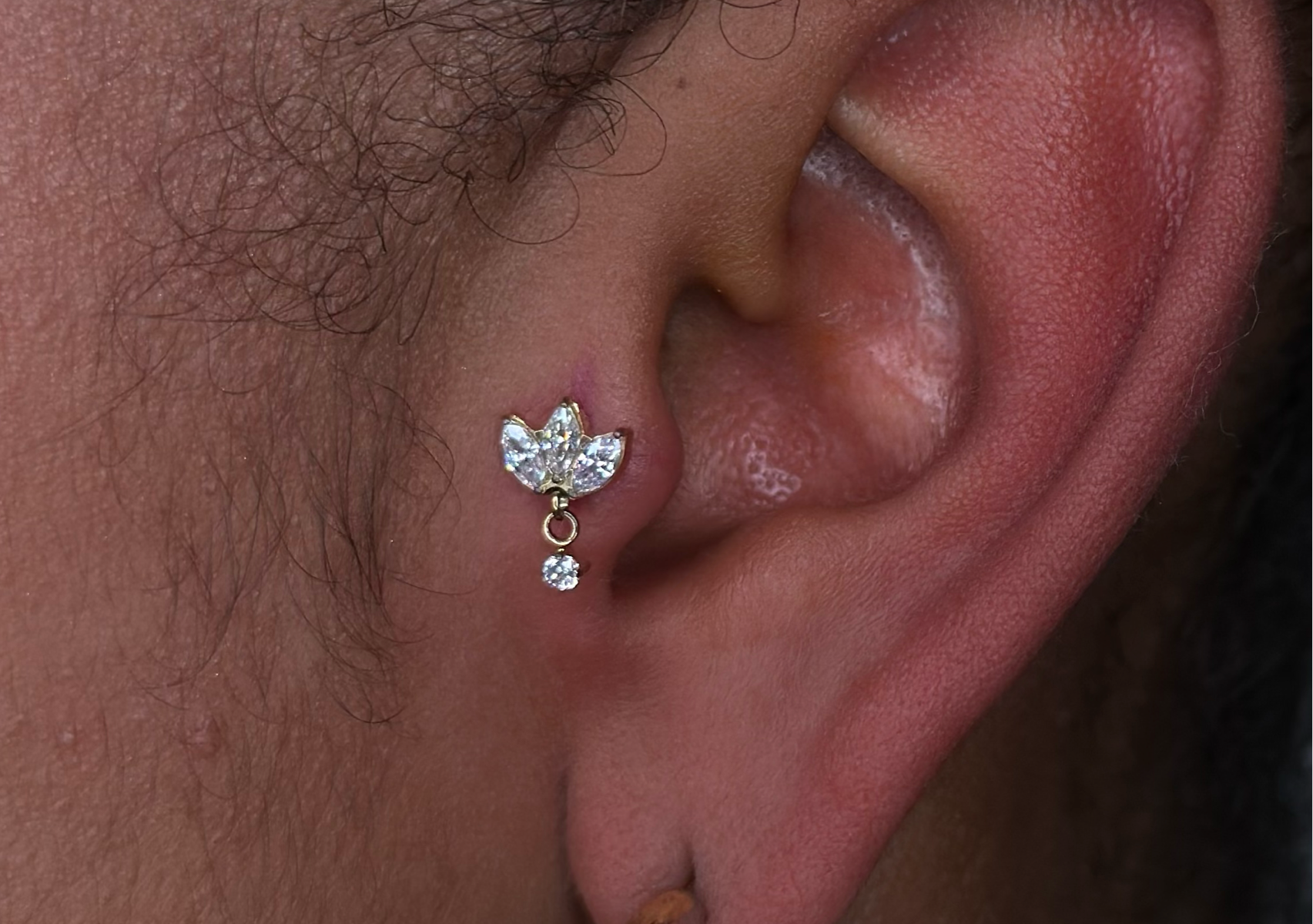 Tragus