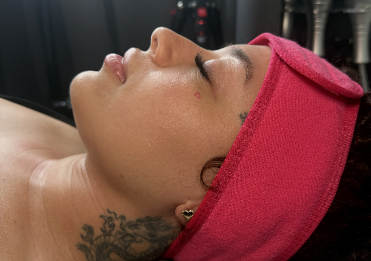 Definicion facial| 6 sesiones