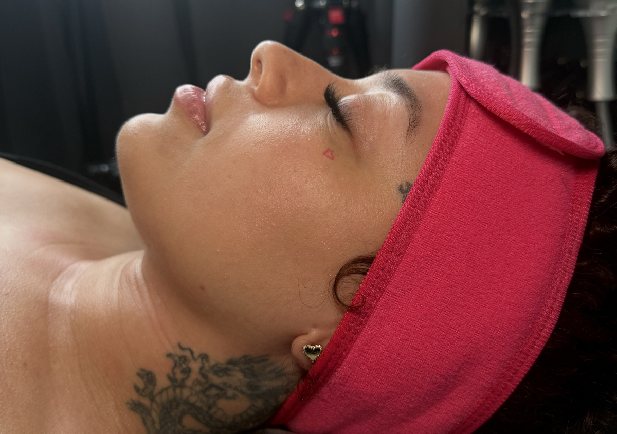 Definicion facial | 1 sesion