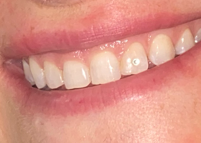 Single Crystal Gem ⟡