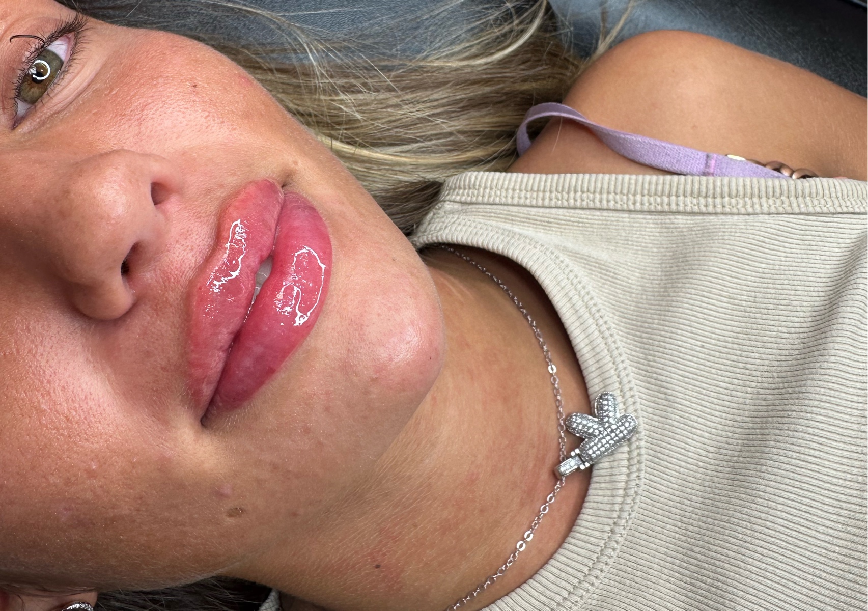 3ml facial contour package 