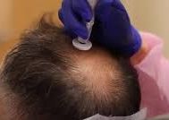 PRO-CELL HAIR TREATMENT