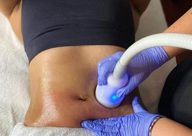 CRYOSKIN SLIMMING 10 PAC