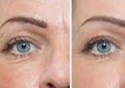 PRO-CELL EYES TREATMENT