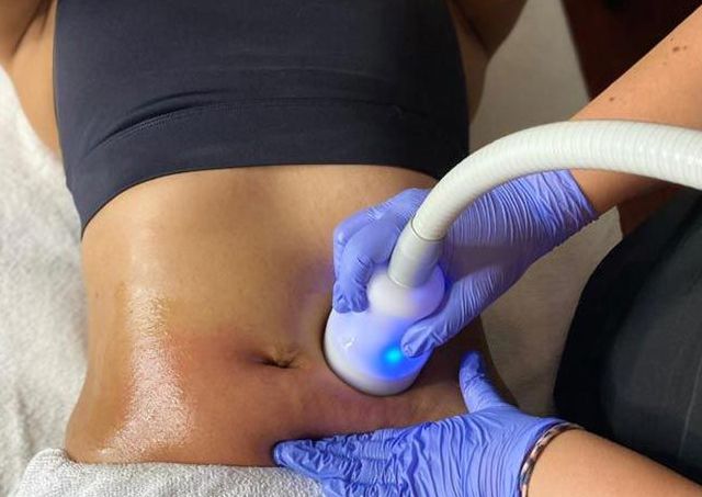 CRYOSKIN SLIMMING 5 PAC