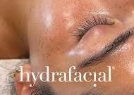 HYDRA FACIAL