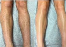 MEN FULL LEGS WAXING