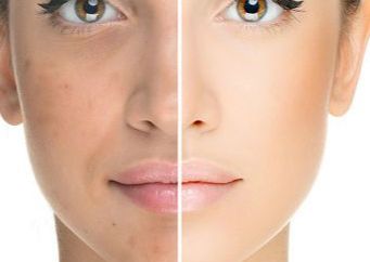 FACE AND NECK POLISH