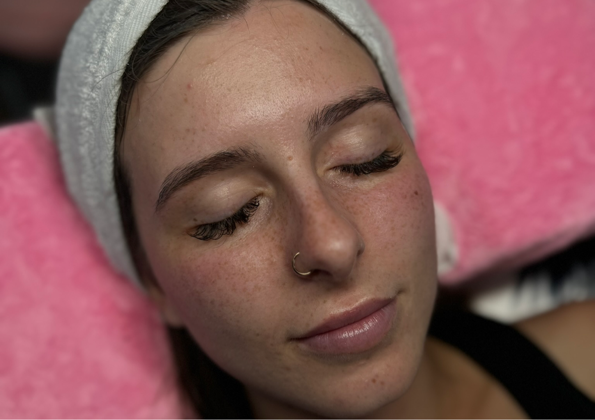 Microdermabrasion Facial only 