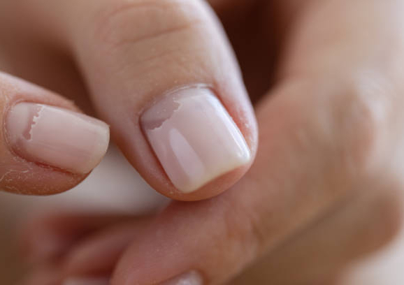 Single nail fix