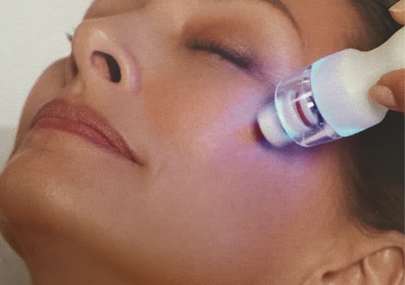 CACI Advanced 