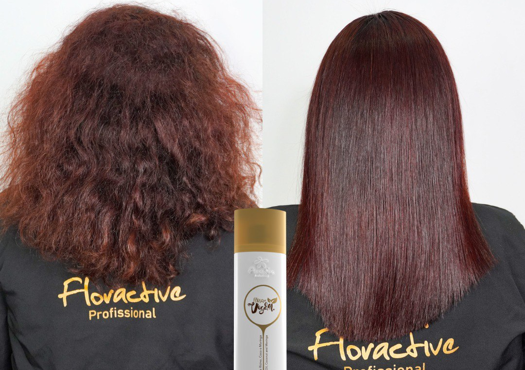 100% Straightening Nanoplasty