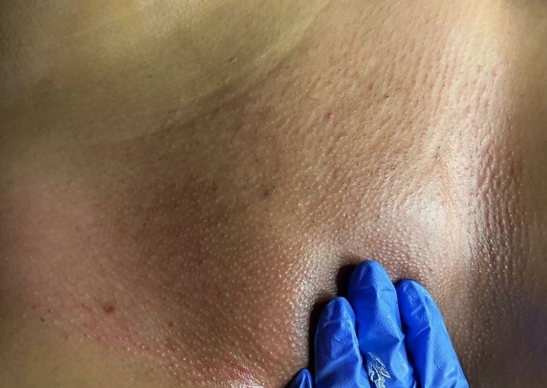 ❤️‍🔥 Brazilian Wax ❤️‍🔥