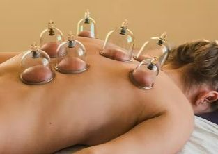 20min Chinese Cupping