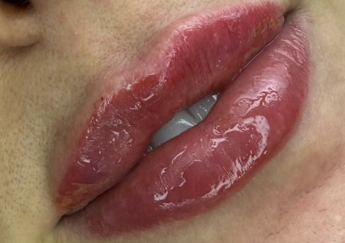 Klarna Sinful Signature Lips