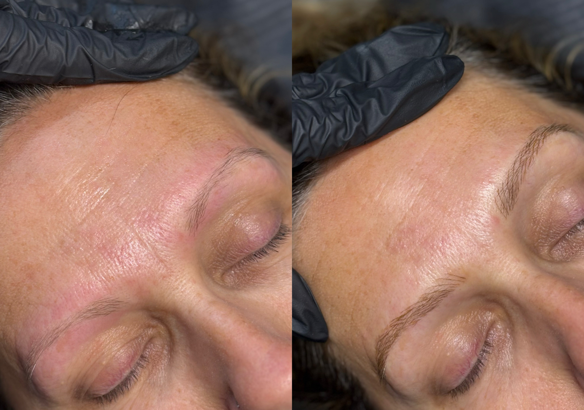 Microblading 