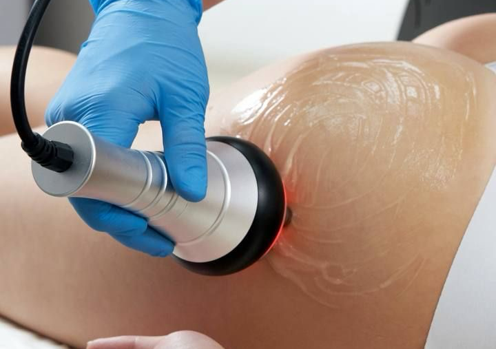 Cupping Massage/Coppettazione contratture/ Slim Massage