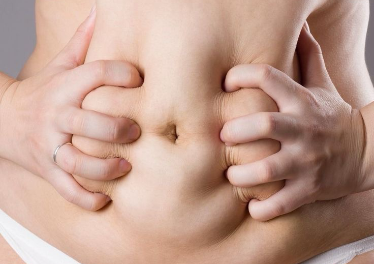 Microneedling per gli inestetismi di grasso, lassita’, cellulite