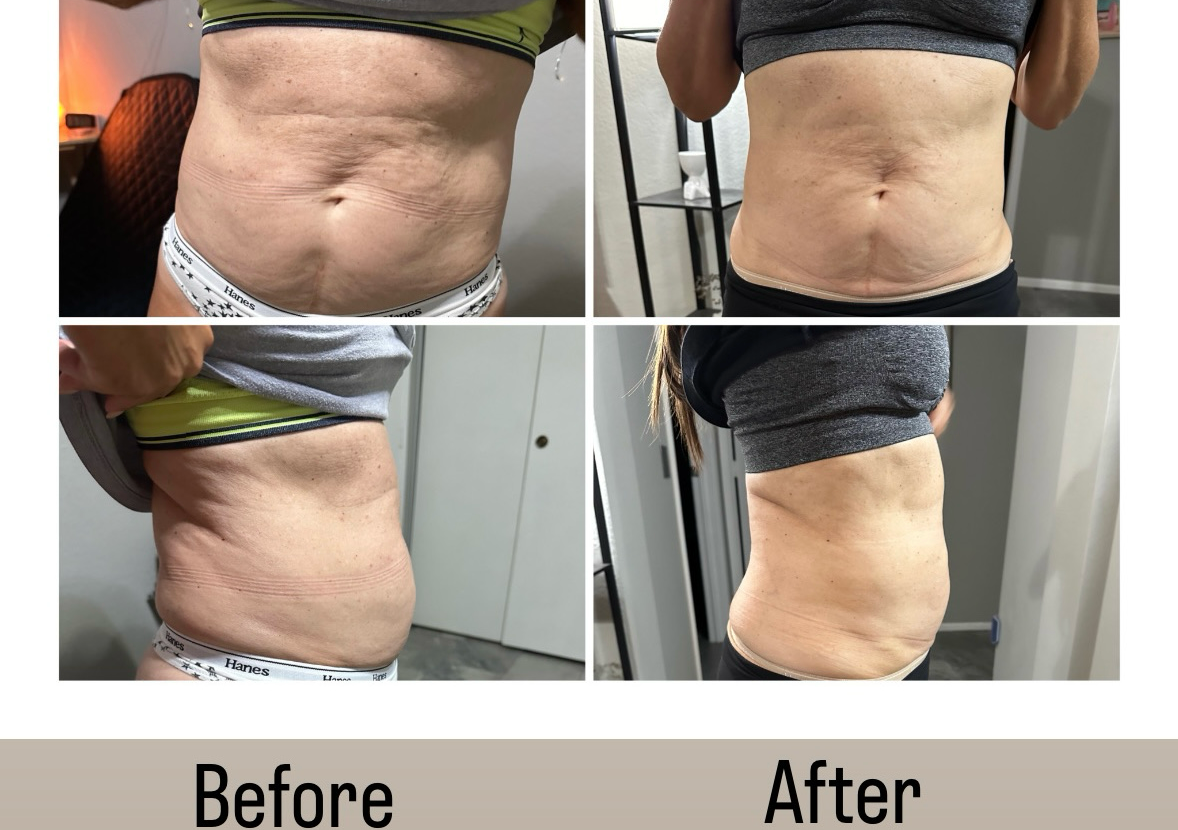 Ultra sonic fat burning 