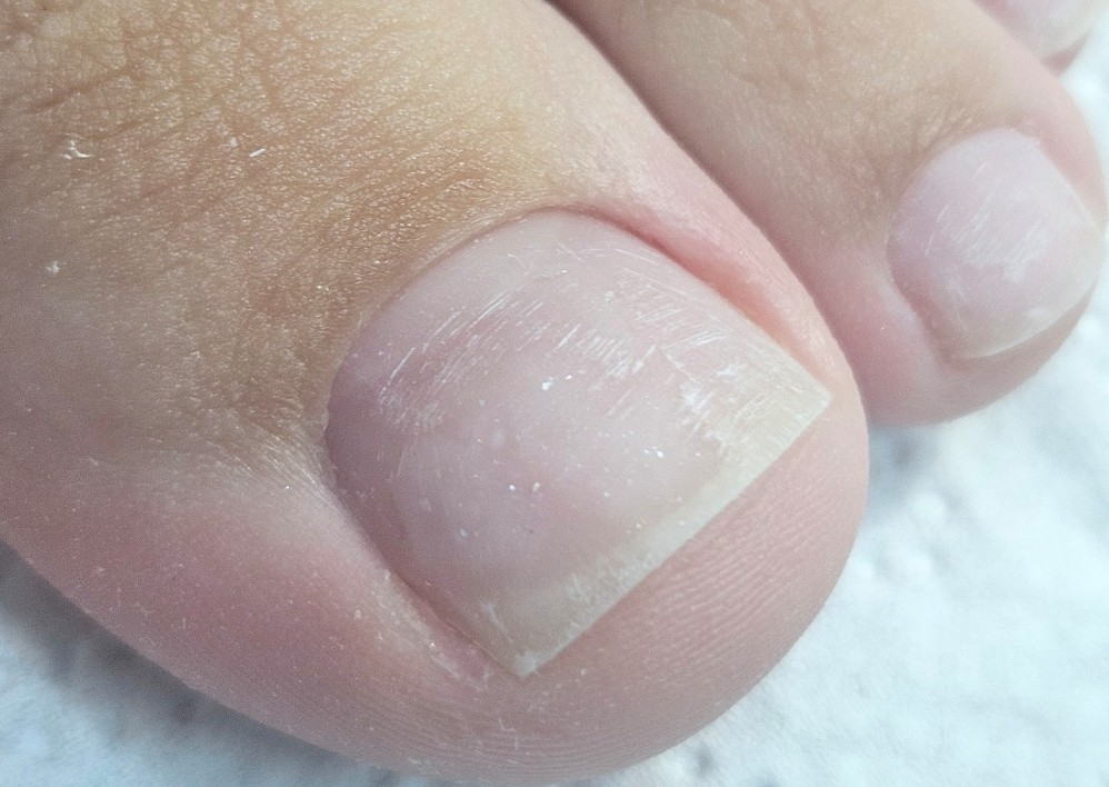 Pedichiura clasica , curatare si igienizare cuticula 