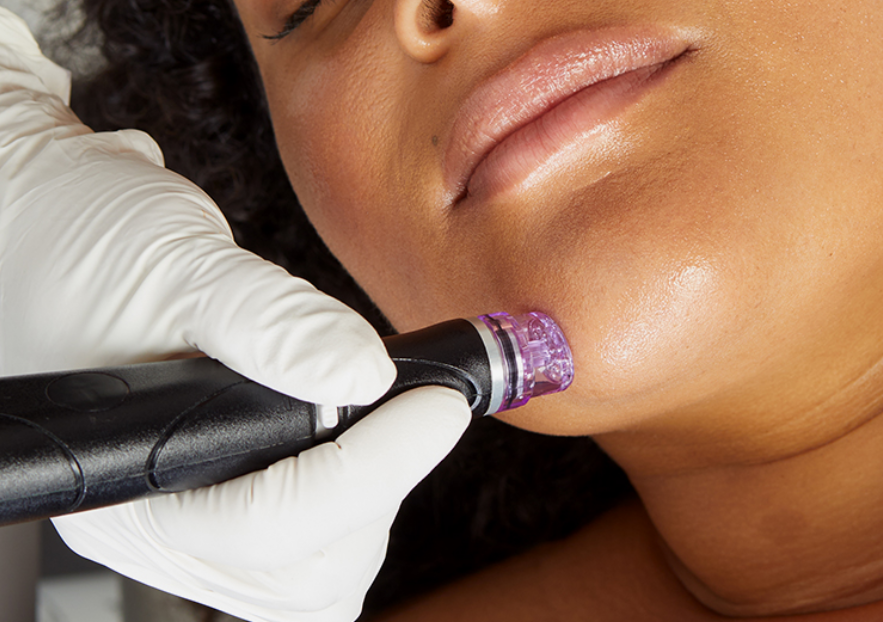 Specialized HYDRAFACIAL