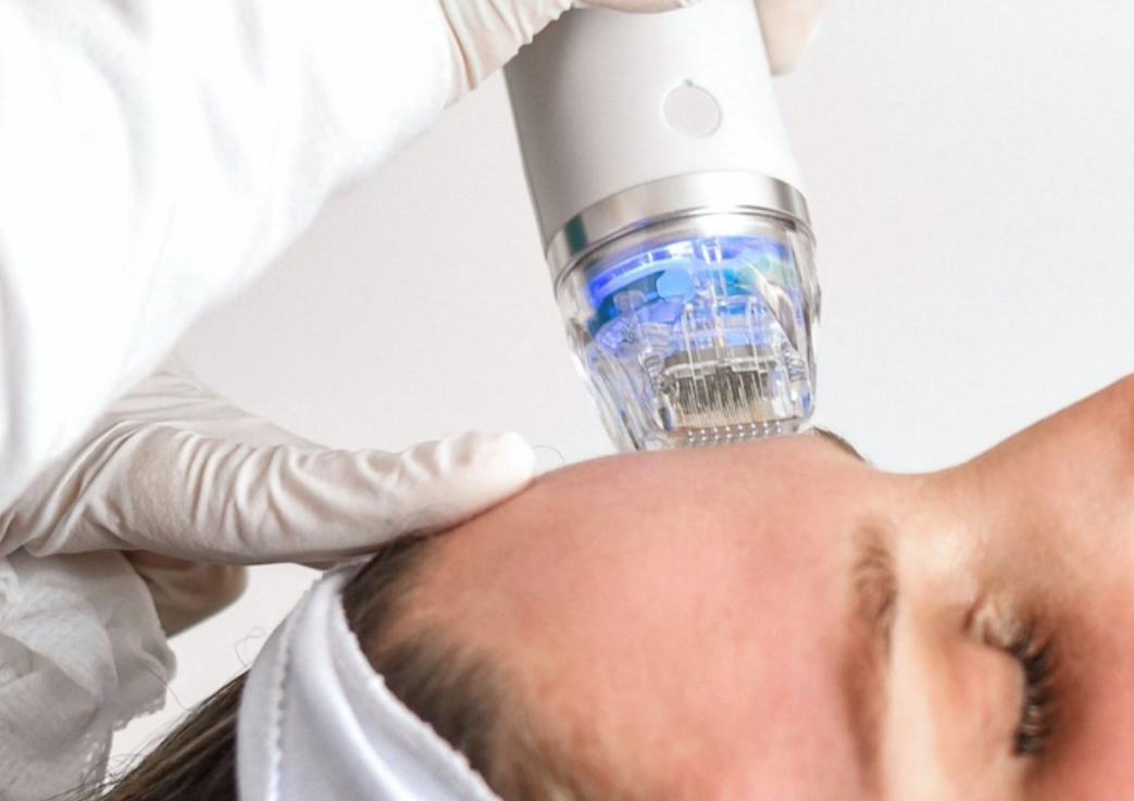 Fractional RF Microneedling 