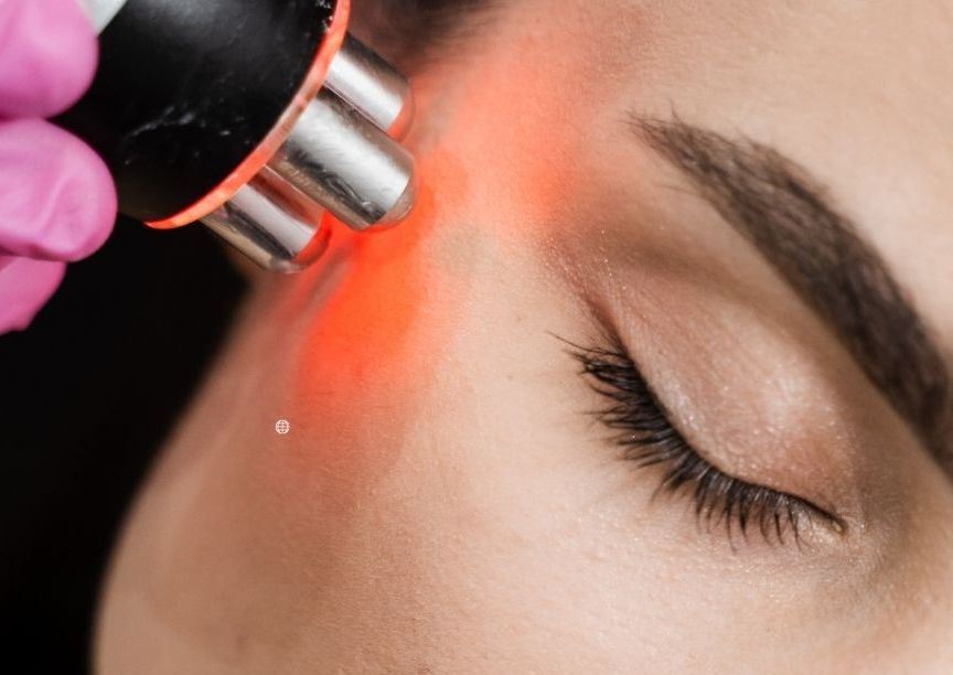 Radiofrequency Facial