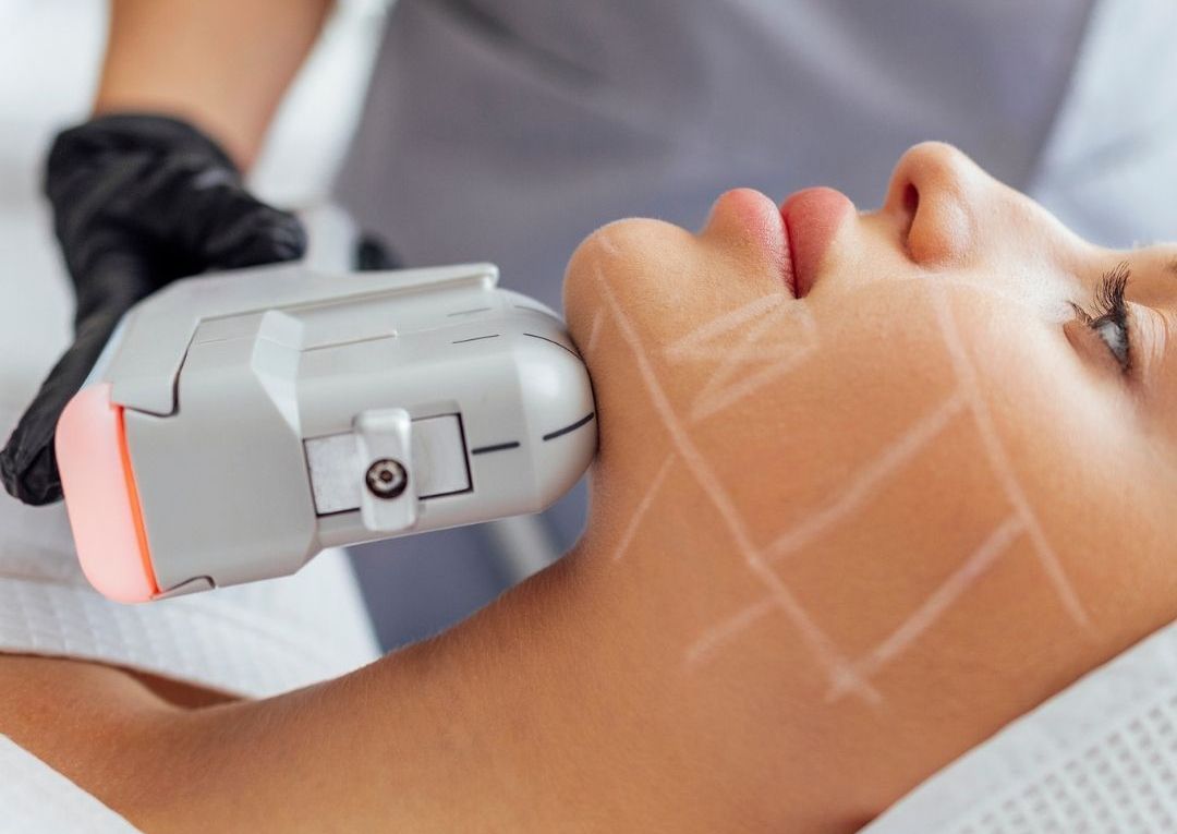 HIFU FACE - Half Face & Neck