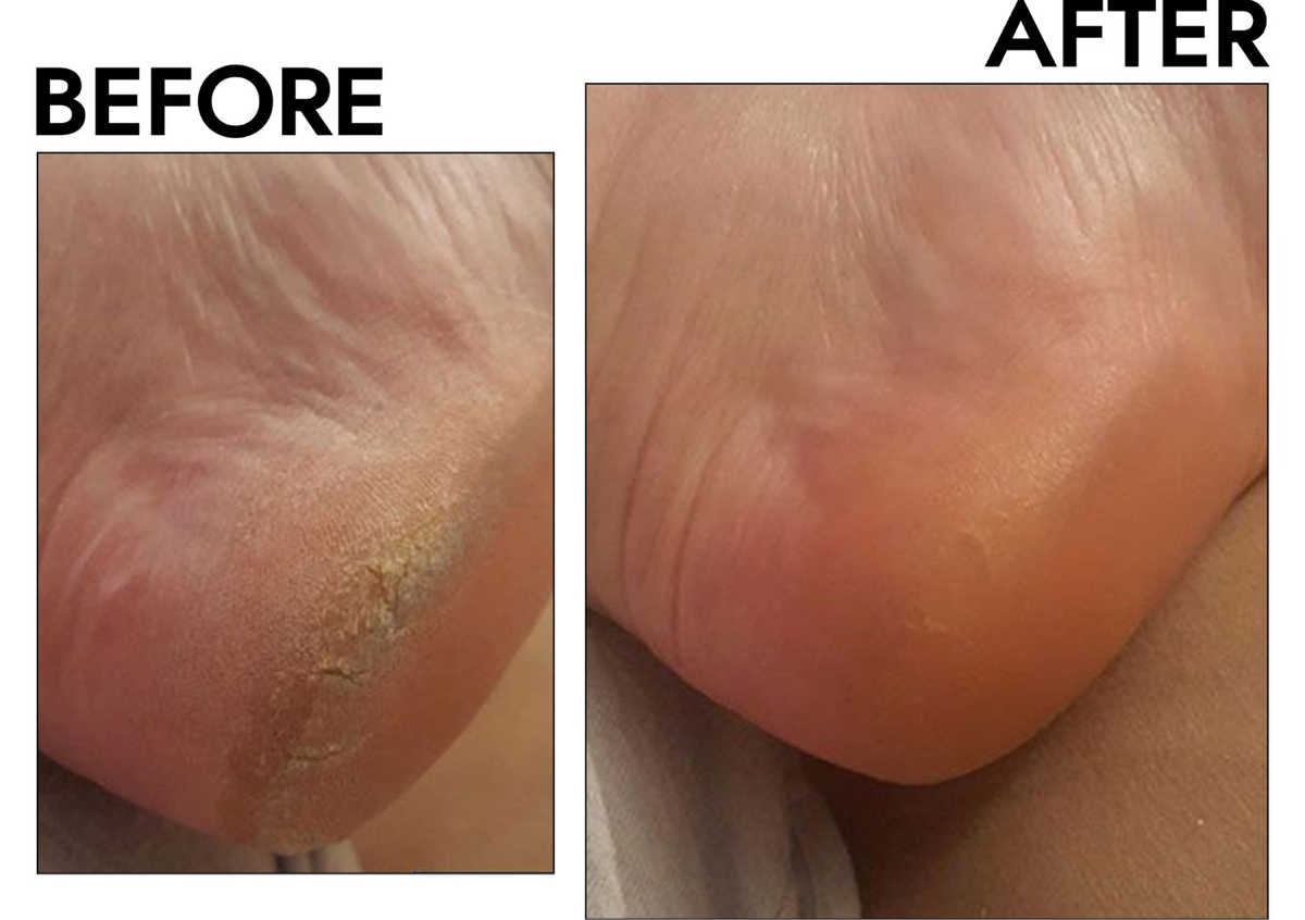 Pedicure [foot scrub] and gel