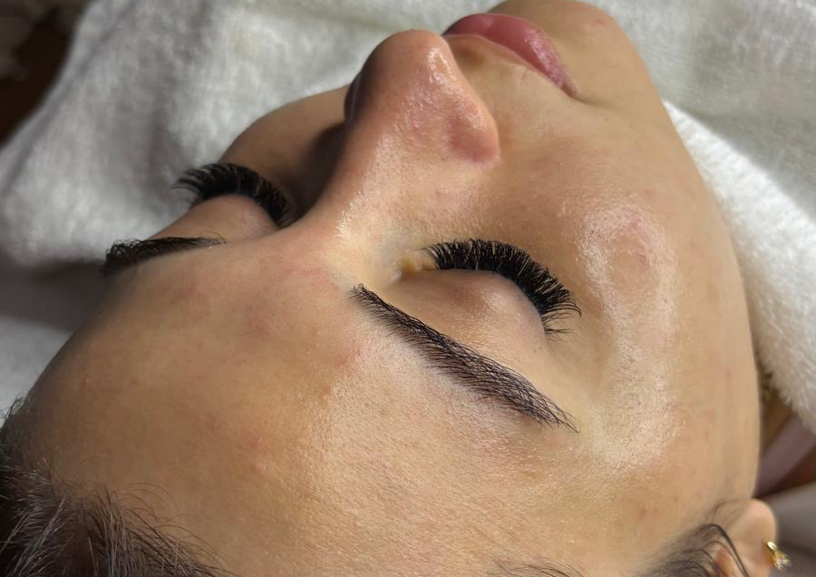 Limpieza Facial Profundo