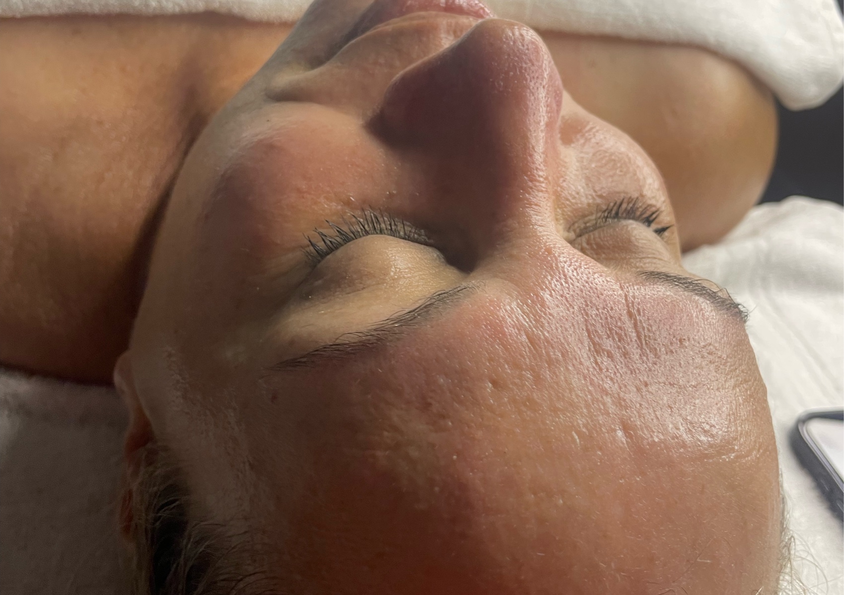 Facial anti envejecimiento