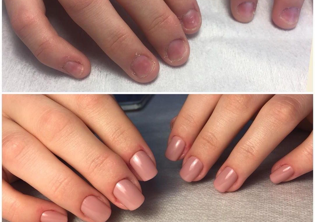 Full Gel Rebuild — Nail Biters