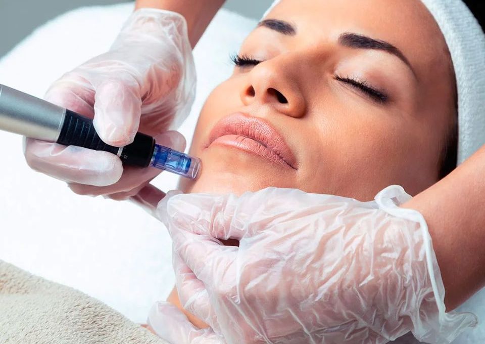 Microneedling con Ácido Hialurónico + Vitamina C + Glutatión