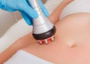 Radiofrecuencia Corporal