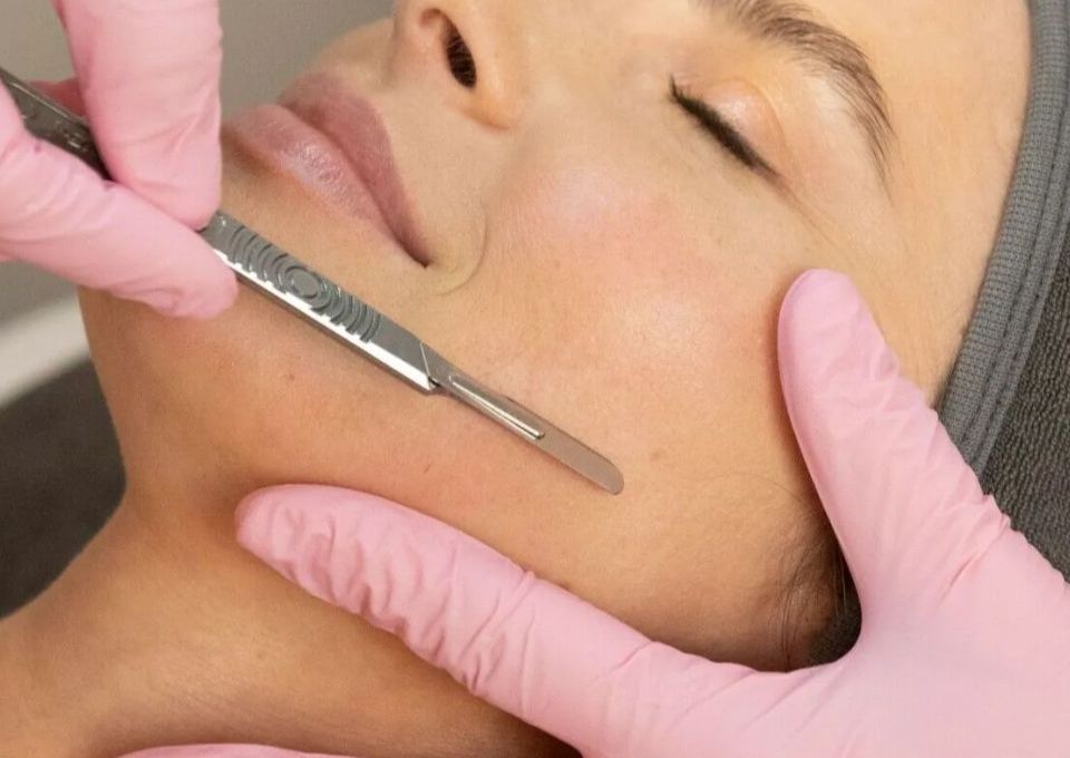 Dermaplaning