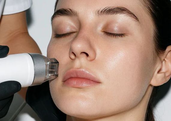 Radiofrecuencia Fraccionada