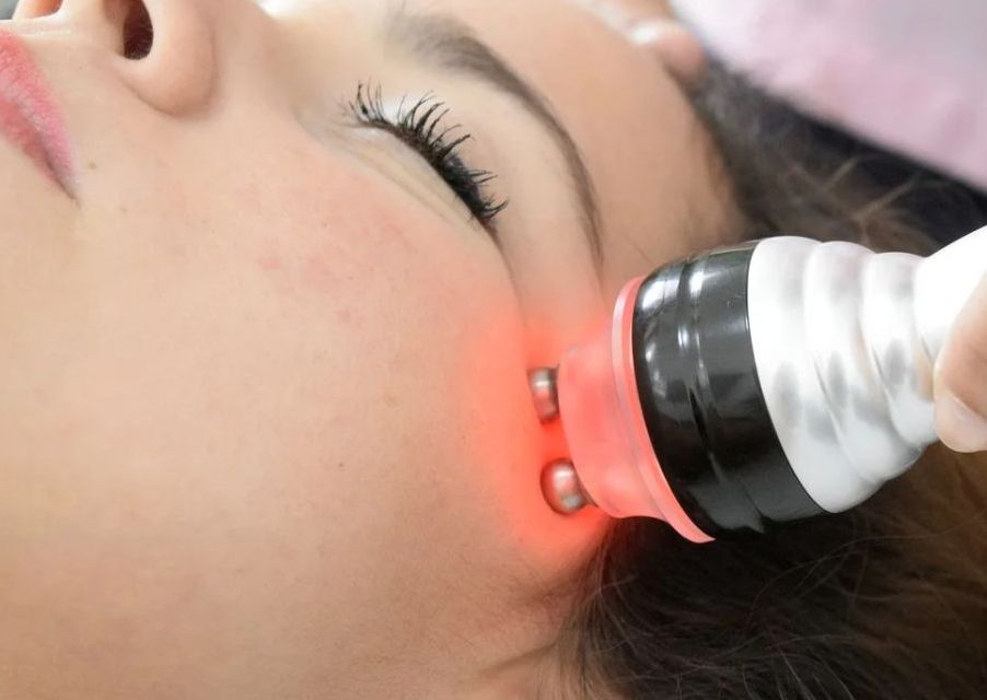 Radiofrecuencia Facial