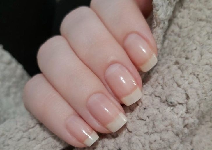 Dépose résine ou gel  