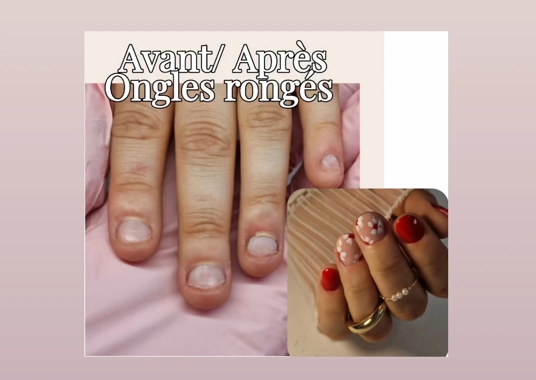 Rallongement ongles rongés/ Nail art simple 
