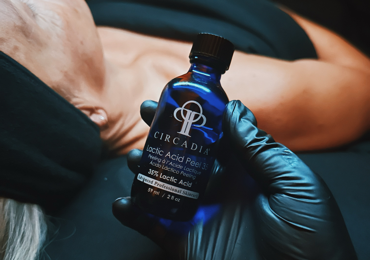 Chemical Peel