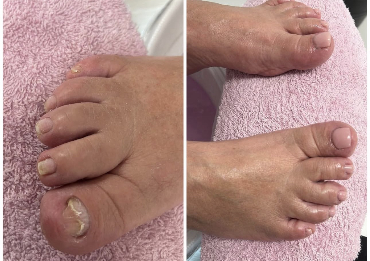 Pedicura spa 
