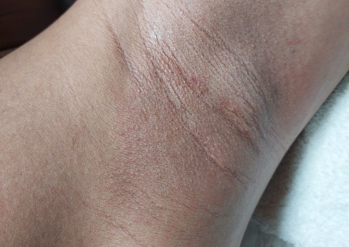 Underarm Wax
