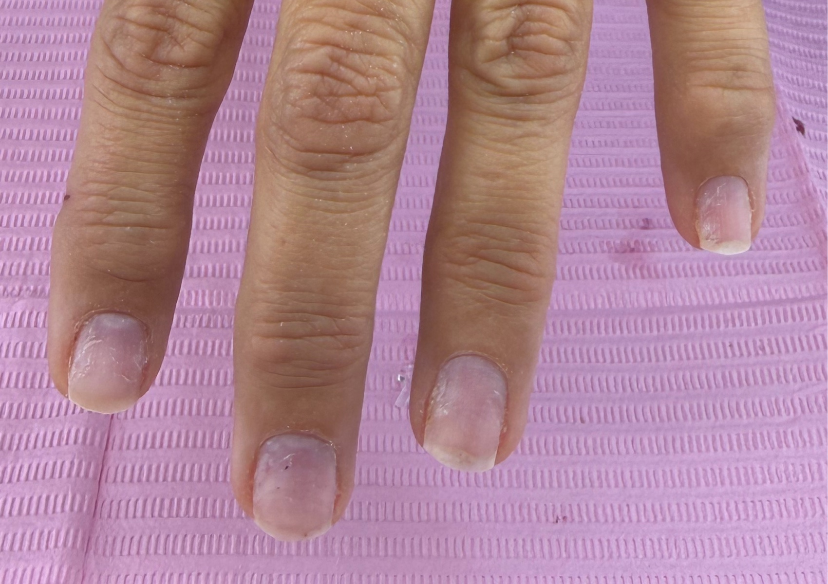 Take  off nail sets only my work 